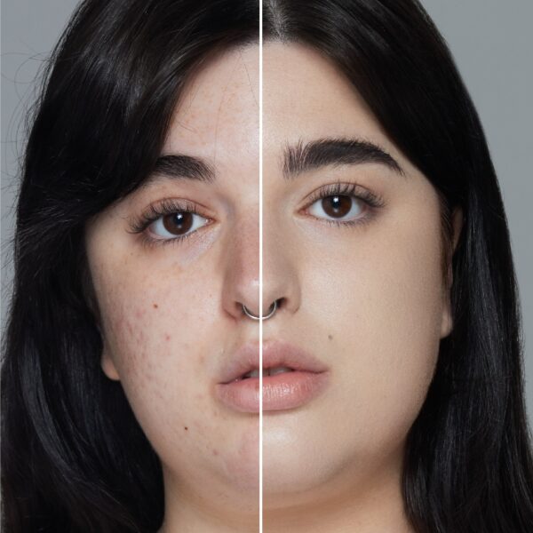 Skin Stick - Image 6